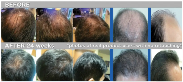 hairboom 비포에프터.png