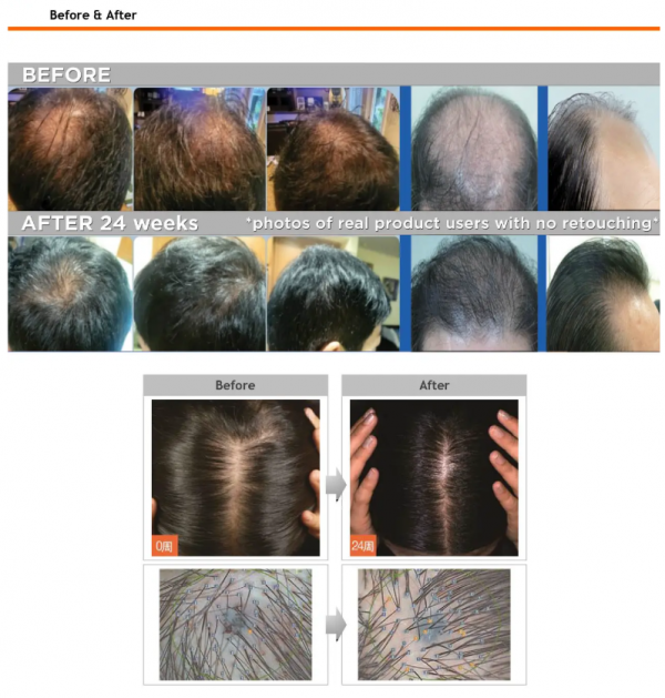 비포에프터 헤어붐.png