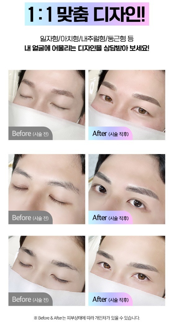 남자 비포에프터.jpg