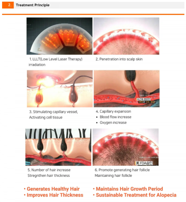 헤어붐 치료과정.png