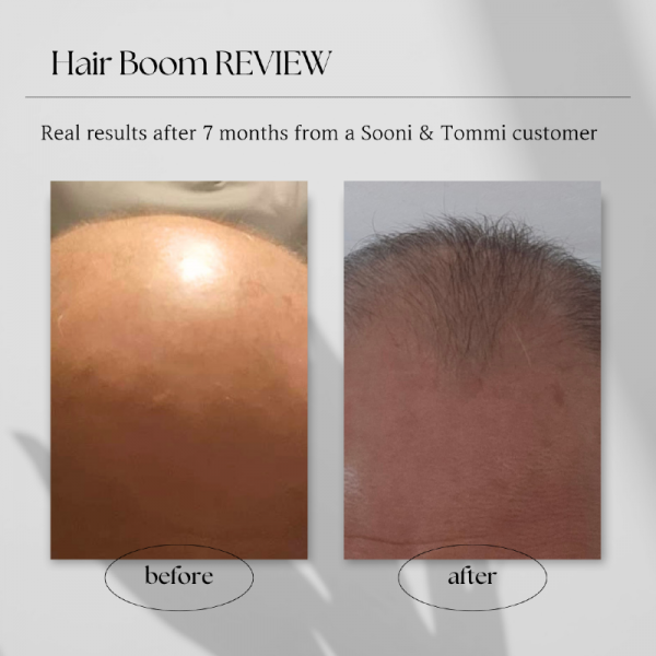 뉴트럴 미니멀리스트 에스테틱 before &amp; after 인스타그램 포스트.png